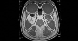 diag image